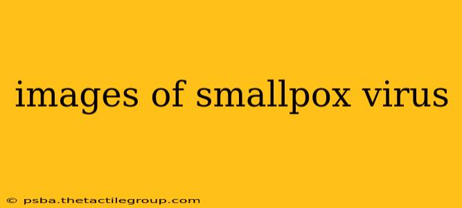 images of smallpox virus